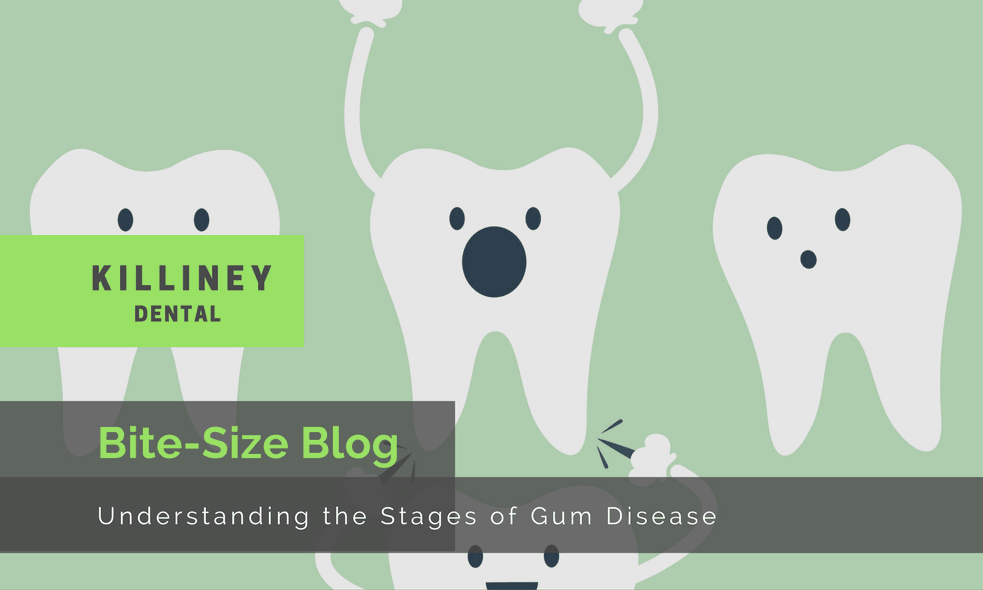 Understanding the Stages of Gum Disease
